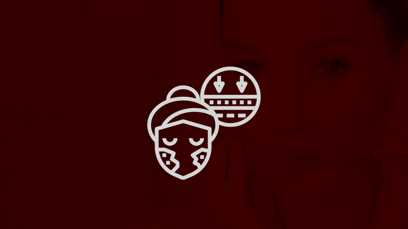 Red Light Therapy for Melasma